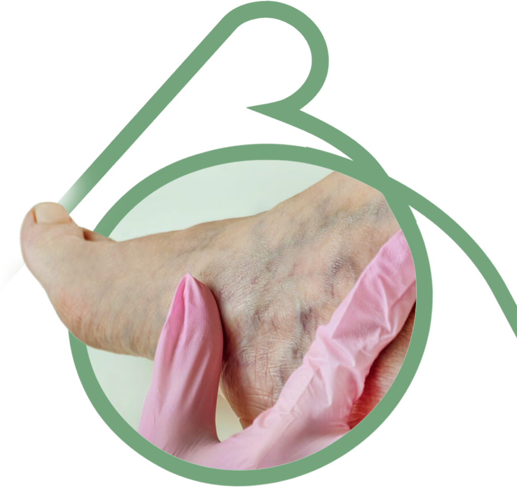 Diabete - Clínica Vascular em São Bernardo e Santo André