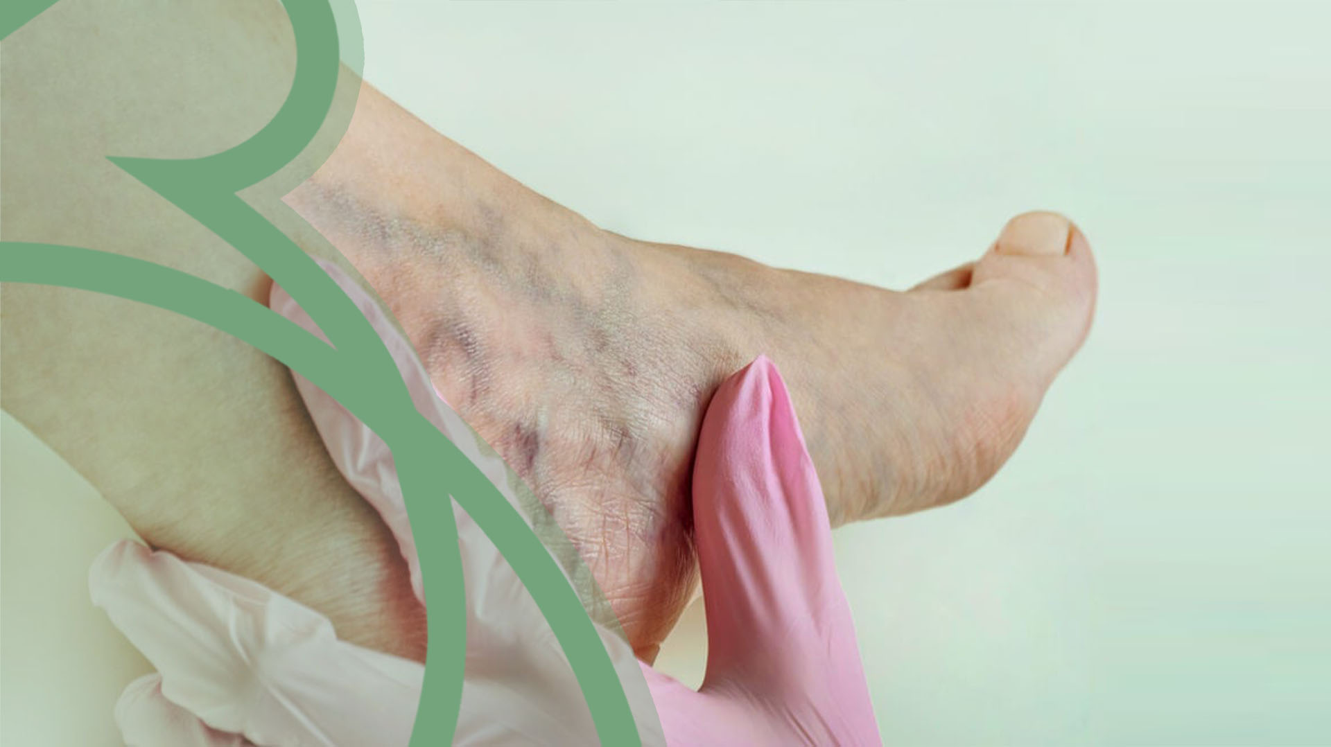 Diabete - Clínica Vascular em São Bernardo e Santo André