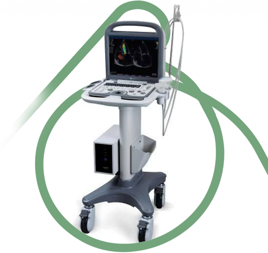 Exames - Aparelho Terason System Ultrasom Eco Color Doppler - Clínica Vascular em São Bernardo e Santo André