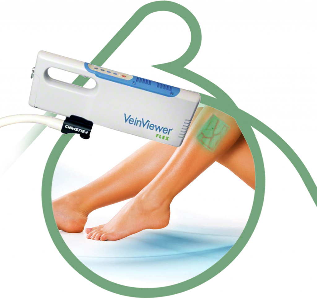 Exames - Aparelho VeinViewer Flex Realidade Aumentada - Clínica Vascular em São Bernardo e Santo André