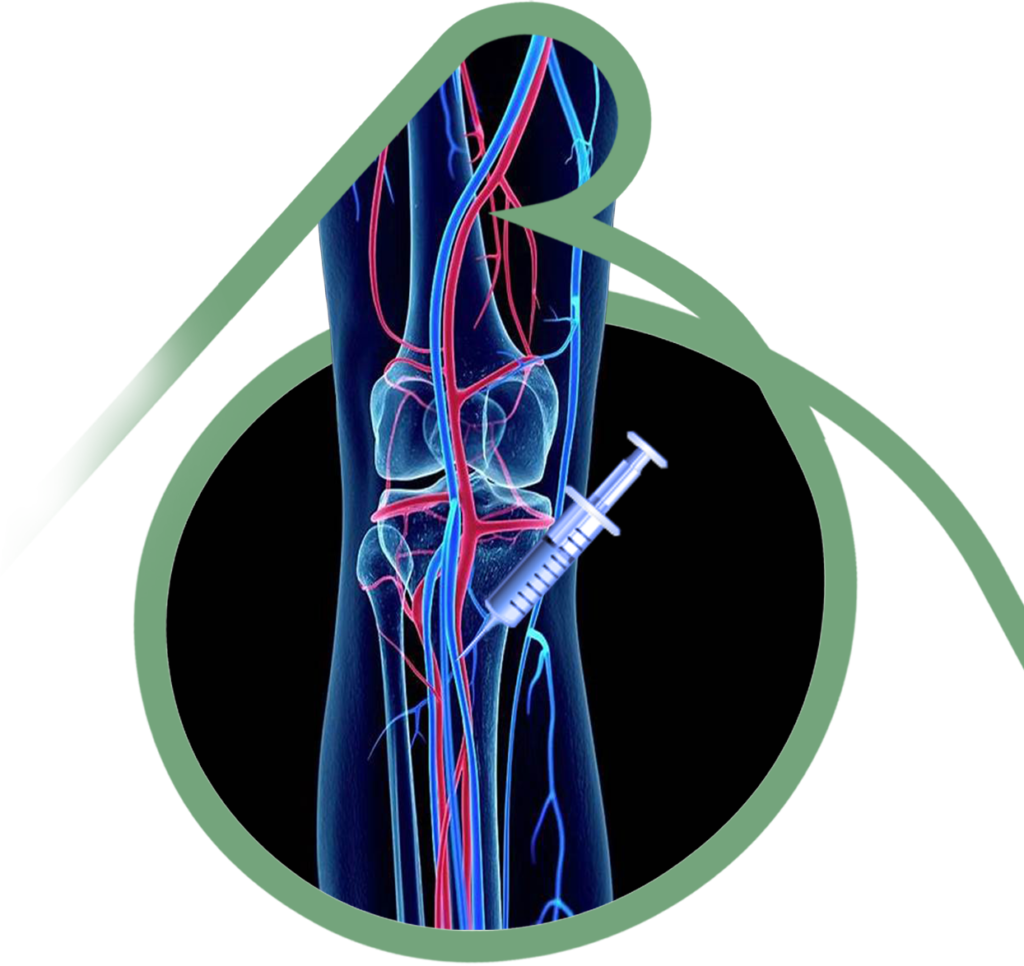 Tratamento de Varizes - Clínica Vascular em São Bernardo e Santo André
